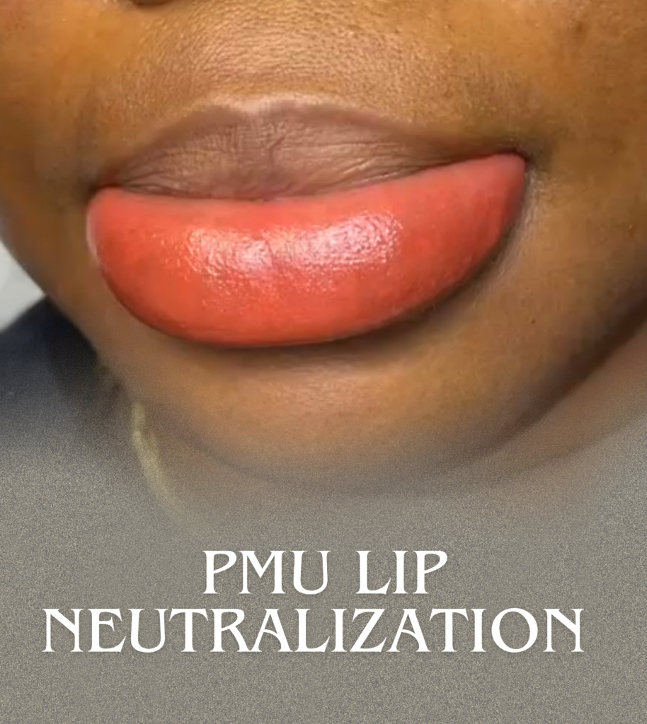 Lip neutralization treatment for uneven or dark lip tones