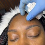 brow correction