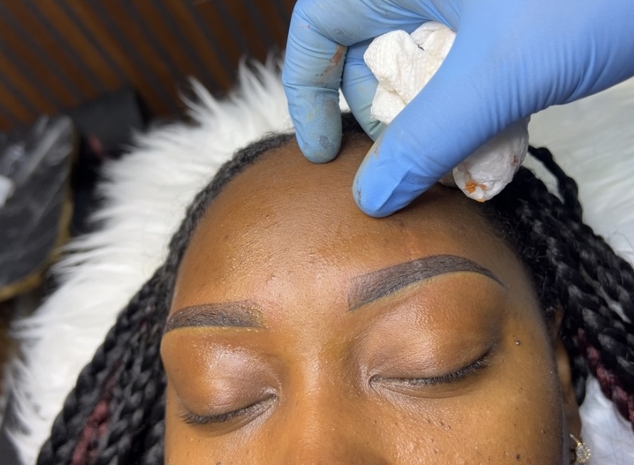 brow correction